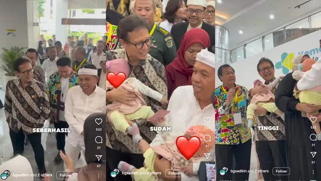 Sukses Operasi Kembar Siam RSHS: Menkes Budi Pantau Kondisi Sehat