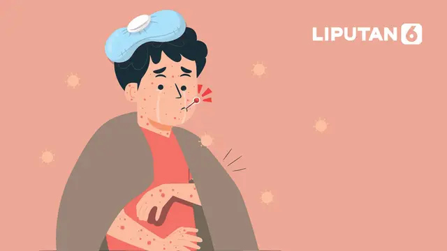 WHO Perpanjang Darurat Global Mpox: Inilah Alasannya